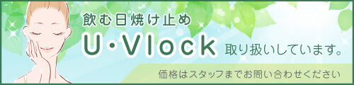 U・Vlock